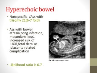 Hyperechoic bowel
• Nonspecific /Ass with
trisomy 21(6-7 fold)
• Ass.with bowel
atresia,cong infection,
meconium ileus,
increased risk of
IUGR,fetal demise
,placenta related
complication
• Likelihood ratio is 6.7
 