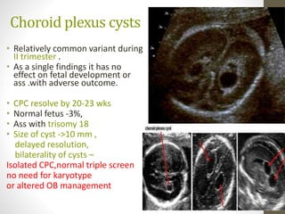Choroid plexus cysts
• Relatively common variant during
II trimester .
• As a single findings it has no
effect on fetal development or
ass .with adverse outcome.
• CPC resolve by 20-23 wks
• Normal fetus -3%,
• Ass with trisomy 18
• Size of cyst ->10 mm ,
delayed resolution,
bilaterality of cysts –
Isolated CPC,normal triple screen
no need for karyotype
or altered OB management
 