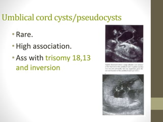 Umblical cord cysts/pseudocysts
•Rare.
•High association.
•Ass with trisomy 18,13
and inversion
 