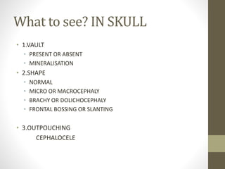 What to see? IN SKULL
• 1.VAULT
• PRESENT OR ABSENT
• MINERALISATION
• 2.SHAPE
• NORMAL
• MICRO OR MACROCEPHALY
• BRACHY OR DOLICHOCEPHALY
• FRONTAL BOSSING OR SLANTING
• 3.OUTPOUCHING
CEPHALOCELE
 