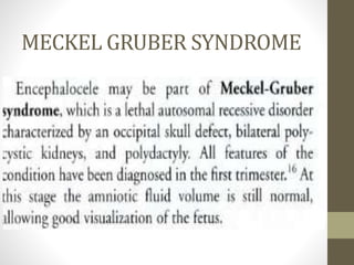 MECKEL GRUBER SYNDROME
 