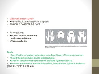 • Lobar holoprosencephaly
• • Very difficult to make specific diagnosis
• AZYGOUUS “WANDERING ” ACA
• All types have:
• • Absent septum pellucidum
and corpus callosum
• • Thalamus fusion
Pearls
• • Identification of septum pellucidum excludes all types of holoprosencephaly.
• • Fused thalami excludes severe hydrocephalus.
• • Anterior cerebral mantle (horseshoe) excludes hydranencephaly.
• • Look for midline facial abnormalities (clefts, hypotelorism, cyclopia, proboscis
(FACE PREDICTS THE BRAIN)
 