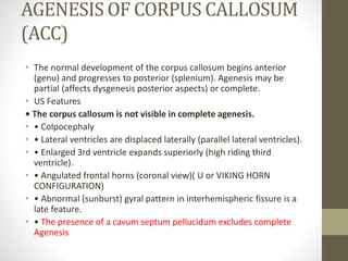 AGENESIS OF CORPUS CALLOSUM
(ACC)
• The normal development of the corpus callosum begins anterior
(genu) and progresses to posterior (splenium). Agenesis may be
partial (affects dysgenesis posterior aspects) or complete.
• US Features
• The corpus callosum is not visible in complete agenesis.
• • Colpocephaly
• • Lateral ventricles are displaced laterally (parallel lateral ventricles).
• • Enlarged 3rd ventricle expands superiorly (high riding third
ventricle).
• • Angulated frontal horns (coronal view)( U or VIKING HORN
CONFIGURATION)
• • Abnormal (sunburst) gyral pattern in interhemispheric fissure is a
late feature.
• • The presence of a cavum septum pellucidum excludes complete
Agenesis
 