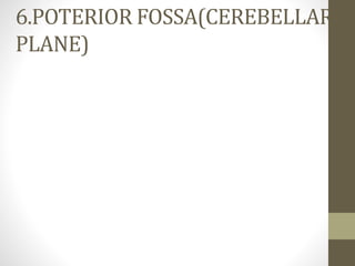 6.POTERIOR FOSSA(CEREBELLAR
PLANE)
 