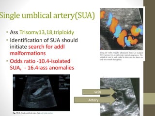 Single umblical artery(SUA)
• Ass Trisomy13,18,triploidy
• Identification of SUA should
initiate search for addl
malformations
• Odds ratio -10.4-isolated
SUA, - 16.4-ass anomalies
vein
Artery
 