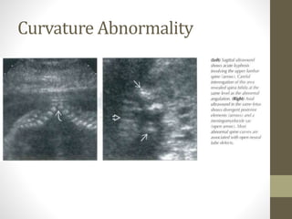 Curvature Abnormality
 