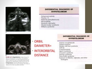 • ORBIL
DAIMETER=
• INTERORBITAL
DISTANCE
 