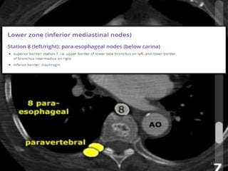 TARGET DELINEATION OF THORACIC NODAL. STATION | PPTX