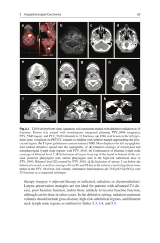 Target Volume Delineation and Field Setup.pdf
