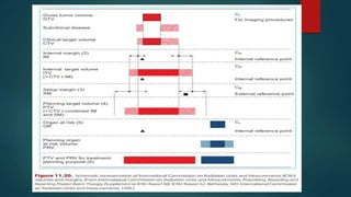 Target Min Volume TARGET VOLUMES IN RADIATION ONCOLOGY.pptx