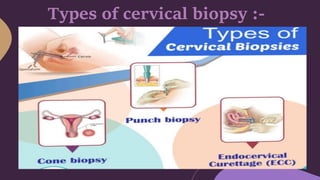 Pap smear test and biopsy of cervix. | PDF