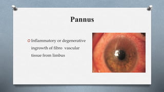 Corneal Diseases / abnormalities | PPTX