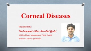 Corneal Diseases
Presented By:
Muhammad Akbar Raashid Qadri
MS Healthcare Management, Public Health
Scholar, Clinical Optometrist
 