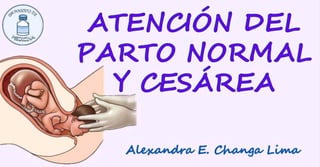 Tarjetas - Atención de parto normal y cesárea.pdf