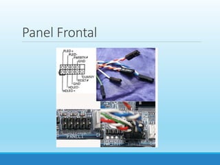 Panel Frontal
 