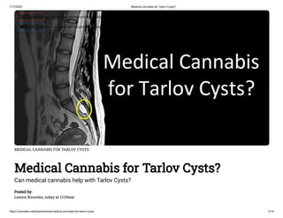 Is Medical Marijuana for Tarlov Cysts?