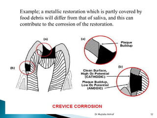 Example; a metallic restoration which is partly covered by
food debris will differ from that of saliva, and this can
contribute to the corrosion of the restoration.
Dr Mujtaba Ashraf 32
 