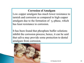 Corrosion of Amalgam
Low copper amalgam has much lower resistance to
tarnish and corrosion as compared to high copper
amalgam due to the formation of γ₂-phase, which
has least resistance to corrosion.
It has been found that phosphate buffer solutions
inhibit the corrosion process; hence, it can be said
that saliva may provide some protection to dental
amalgam from corrosion.
Dr Mujtaba Ashraf 40
 