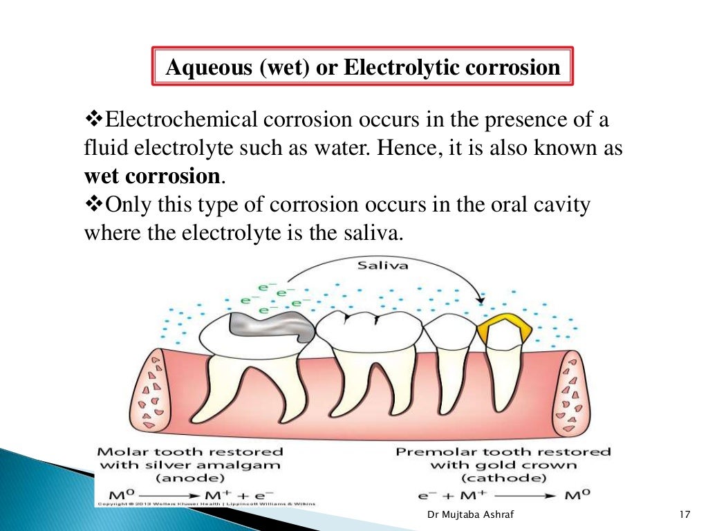 Tarnish & corrosion in dentistry