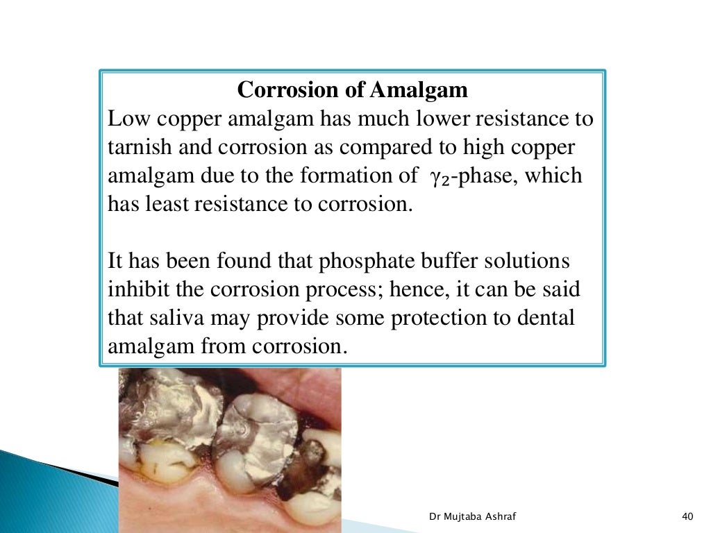 Tarnish & corrosion in dentistry