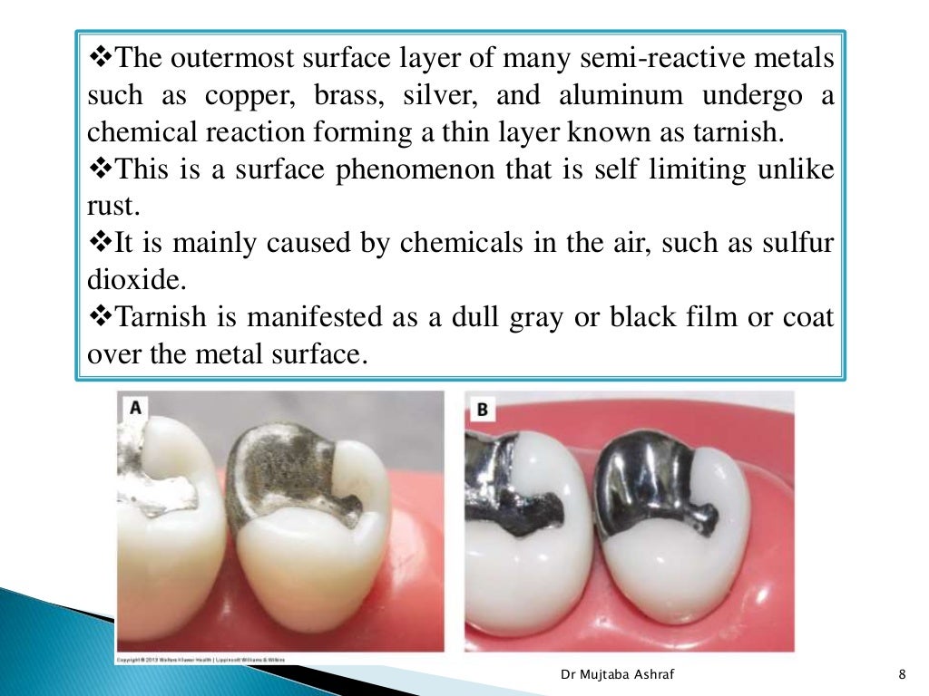Tarnish & corrosion in dentistry