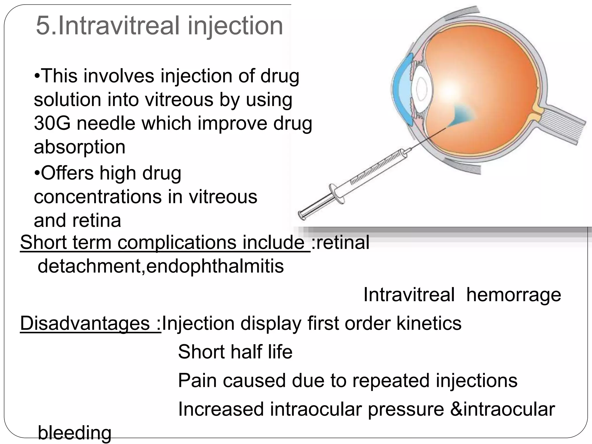 ocular barriers and methods to overcome barriers | PPTX