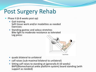 Management of TendoAchillis rupture | PPTX