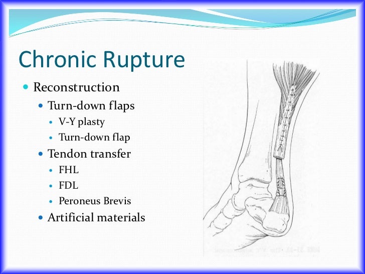 Chronic Achilles Rupture Flexor Hallucis Longus Transfer V Y