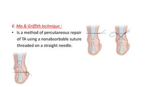 6. Ma & Griffith technique :
• Is a method of percutaneous repair
of TA using a nonabsorbable suture
threaded on a straight needle.
 