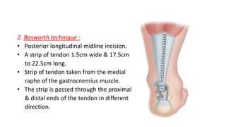 2. Bosworth technique :
• Posterior longitudinal midline incision.
• A strip of tendon 1.5cm wide & 17.5cm
to 22.5cm long.
• Strip of tendon taken from the medial
raphe of the gastrocnemius muscle.
• The strip is passed through the proximal
& distal ends of the tendon in different
direction.
 