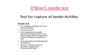 O’Brien’s needle test
 