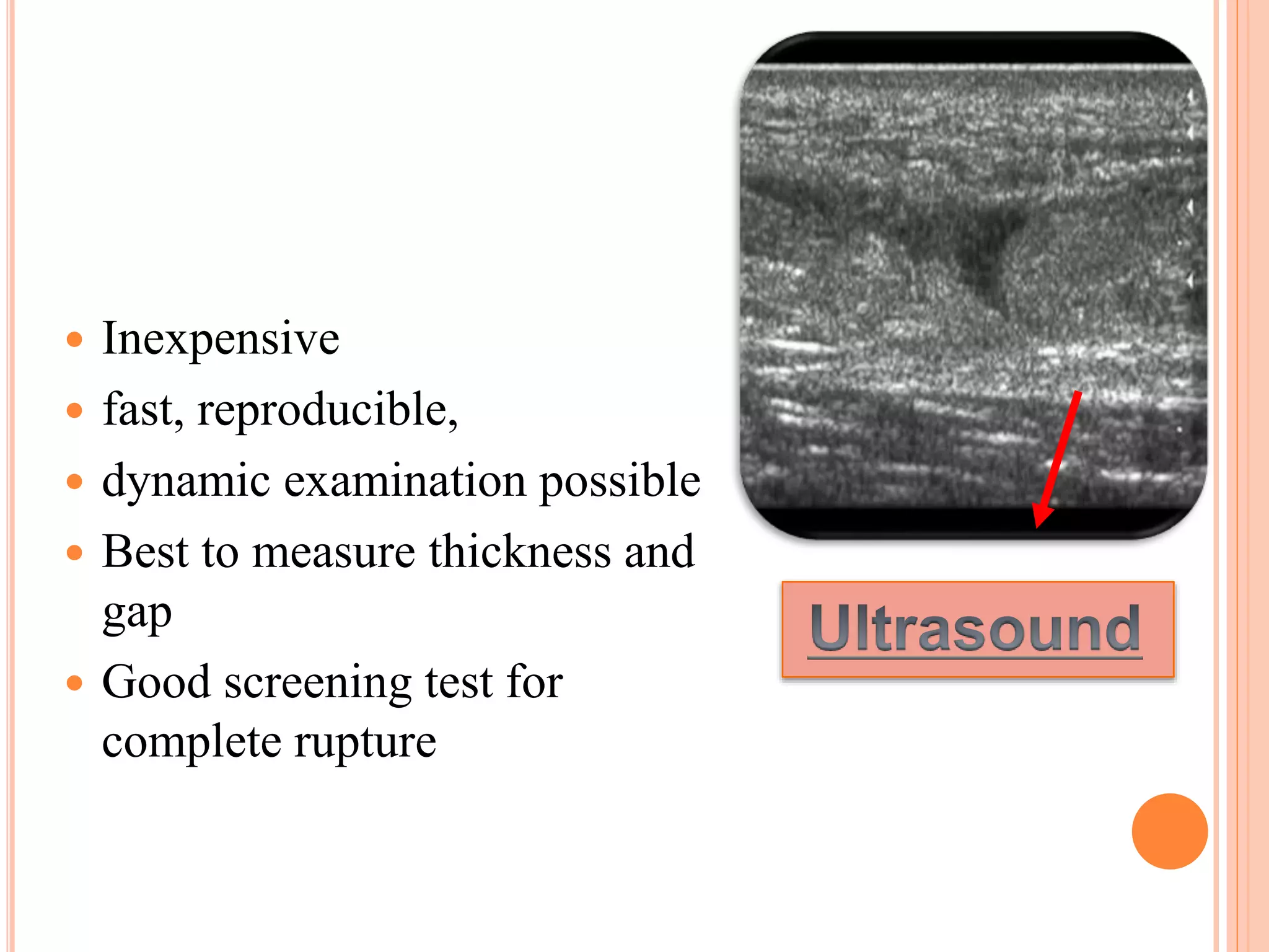 Ta Rupture TA Rupture - DR Chandramani Roy | PPTX
