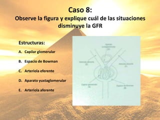 Caso 8:
Observe la figura y explique cuál de las situaciones
disminuye la GFR
Estructuras:
A. Capilar glomerular
B. Espacio de Bowman
C. Arteriola eferente
D. Aparato yuxtaglomerular
E. Arteriola aferente
 