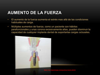 AUMENTO DE LA FUERZA
• El aumento de la fuerza aumenta el estrés mas allá de las condiciones
habituales de carga.
• Múltiples aumentos de fuerza, como un paciente con hábitos
parafuncionales y unas corona excesivamente altas, pueden disminuir la
capacidad de cualquier implante dental de soportarlas cargas oclusales.
Misch, Carl, Implantología contemporánea, tercera edición
 