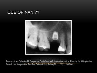 QUE OPINAN ??
Arismendi JA, Cabrales M, Duque JA, Castañeda WR. Implantes cortos. Reporte de 30 implantes.
Parte I: oseointegración. Rev Fac Odontol Univ Antioq 2011; 22(2): 198-204.
 