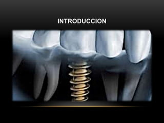 INTRODUCCION
 