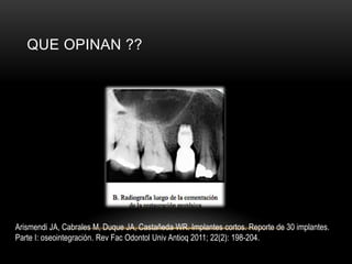QUE OPINAN ??
Arismendi JA, Cabrales M, Duque JA, Castañeda WR. Implantes cortos. Reporte de 30 implantes.
Parte I: oseointegración. Rev Fac Odontol Univ Antioq 2011; 22(2): 198-204.
 