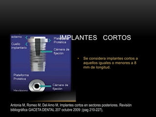 • Se considera implantes cortos a
aquellos iguales o menores a 8
mm de longitud.
IMPLANTES CORTOS
Antonia M, Romeo M, Del Amo M, Implantes cortos en sectores posteriores. Revisión
bibliográfica GACETA DENTAL 207 octubre 2009 ;(pag 210-227),
 