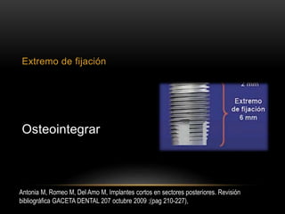 Extremo de fijación
Osteointegrar
Antonia M, Romeo M, Del Amo M, Implantes cortos en sectores posteriores. Revisión
bibliográfica GACETA DENTAL 207 octubre 2009 ;(pag 210-227),
 