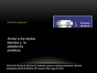 Extremo gingival
Anclar a los tejidos
blandos y la
plataforma
protética.
Antonia M, Romeo M, Del Amo M, Implantes cortos en sectores posteriores. Revisión
bibliográfica GACETA DENTAL 207 octubre 2009 ;(pag 210-227),
 