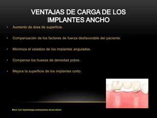 • Aumento de área de superficie.
• Compensación de los factores de fuerza desfavorable del paciente.
• Minimiza el voladizo de los implantes angulados.
• Compensa los huesos de densidad pobre.
• Mejora la superficie de los implantes corto.
Misch, Carl, Implantología contemporánea, tercera edición
 