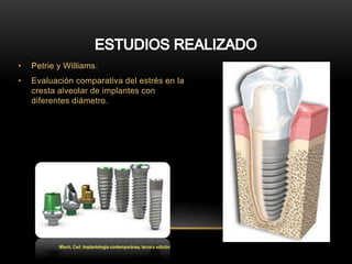 • Petrie y Williams.
• Evaluación comparativa del estrés en la
cresta alveolar de implantes con
diferentes diámetro.
Misch, Carl, Implantologia contemporánea, tercera edición
 