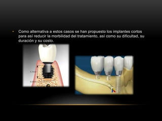• Como alternativa a estos casos se han propuesto los implantes cortos
para así reducir la morbilidad del tratamiento, así como su dificultad, su
duración y su costo.
 