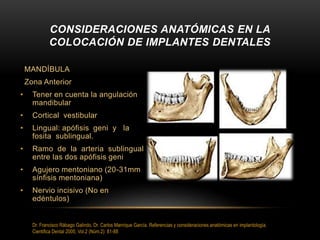 MANDÍBULA
Zona Anterior
• Tener en cuenta la angulación
mandibular
• Cortical vestibular
• Lingual: apófisis geni y la
fosita sublingual.
• Ramo de la arteria sublingual
entre las dos apófisis geni
• Agujero mentoniano (20-31mm
sínfisis mentoniana)
• Nervio incisivo (No en
edéntulos)
CONSIDERACIONES ANATÓMICAS EN LA
COLOCACIÓN DE IMPLANTES DENTALES
Dr. Francisco Rábago Galindo, Dr. Carlos Manrique García. Referencias y consideraciones anatómicas en implantología.
Cientifica Dental 2005; Vol.2 (Núm.2): 81-88
 