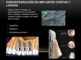 Según Carlos Venegas, la
oseointegración es la conexión
firme, estable y duradera entre un
implante sujeto a carga y el hueso
que lo rodea.
• Superficie
• Diámetro
• Estabilidad primaria
OSEOINTEGRACIÓN EN IMPLANTES CORTOS Y
LARGOS
 