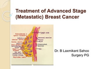Treatment of Advanced Stage
(Metastatic) Breast Cancer
By. Dr. B Laxmikant Sahoo
Surgery PG
 