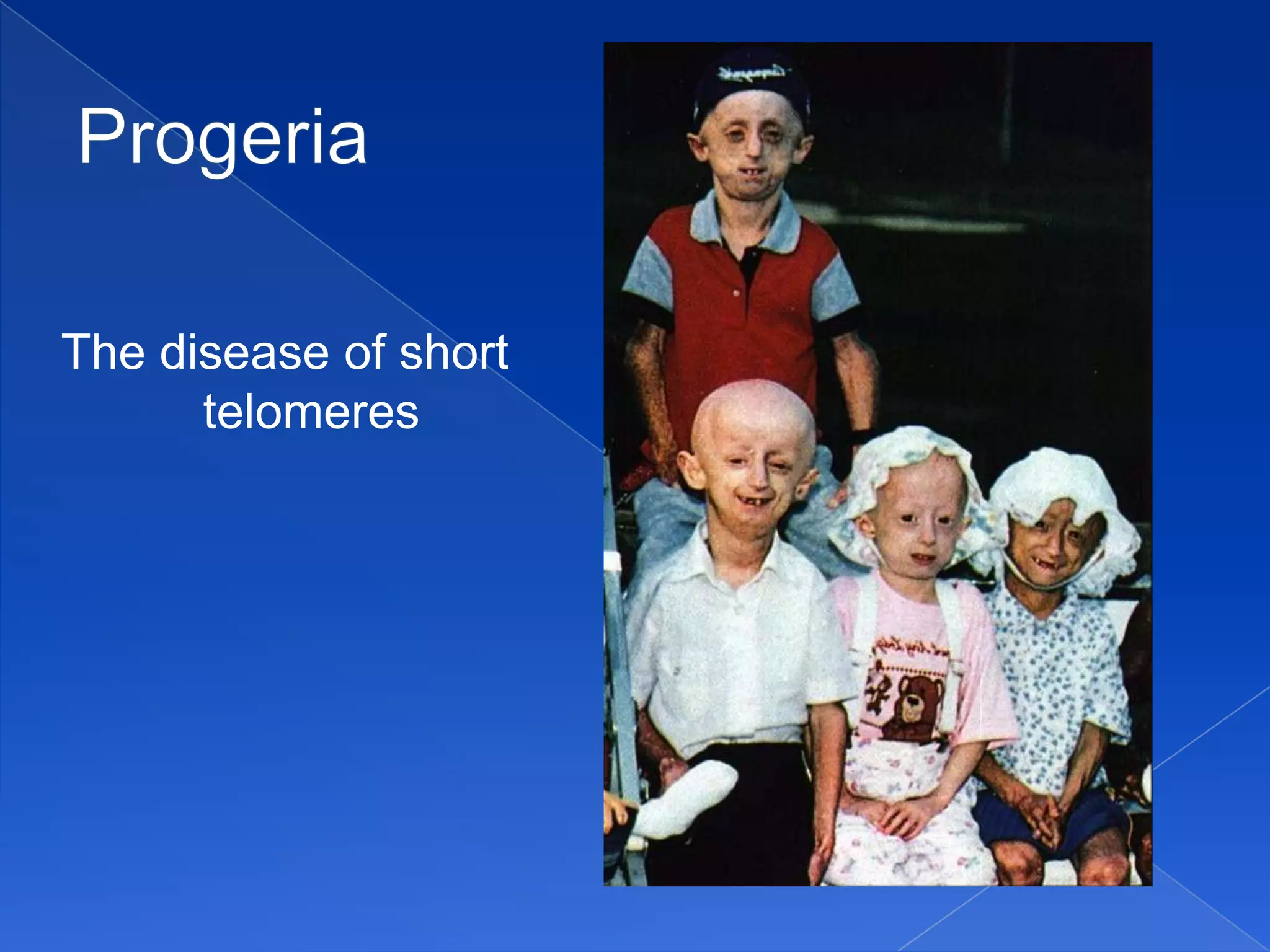 The disease of short
      telomeres
 