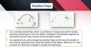 Flaps used in Maxillofacial Surgery.pptx