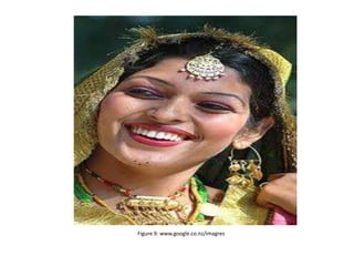 Figure 9: www.google.co.nz/imagres
 