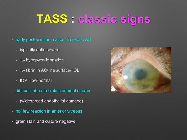 TASS vs Endophthalmitis | PPT